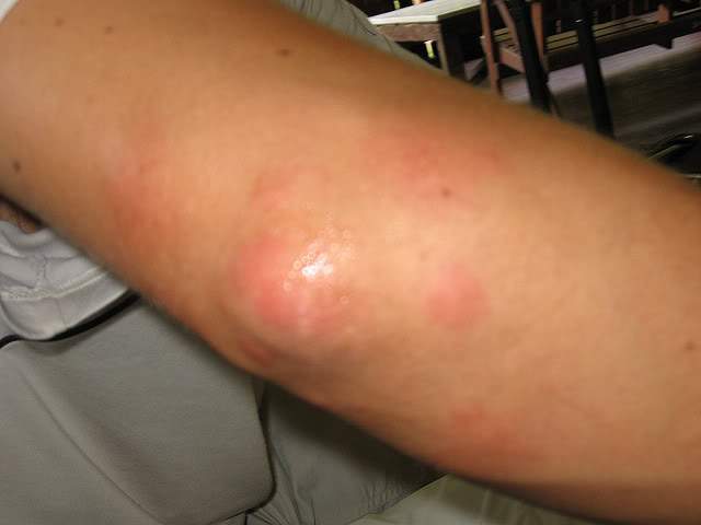 ai138.photobucket.com_albums_q278_CarlosLuz_IMG_0416.jpg